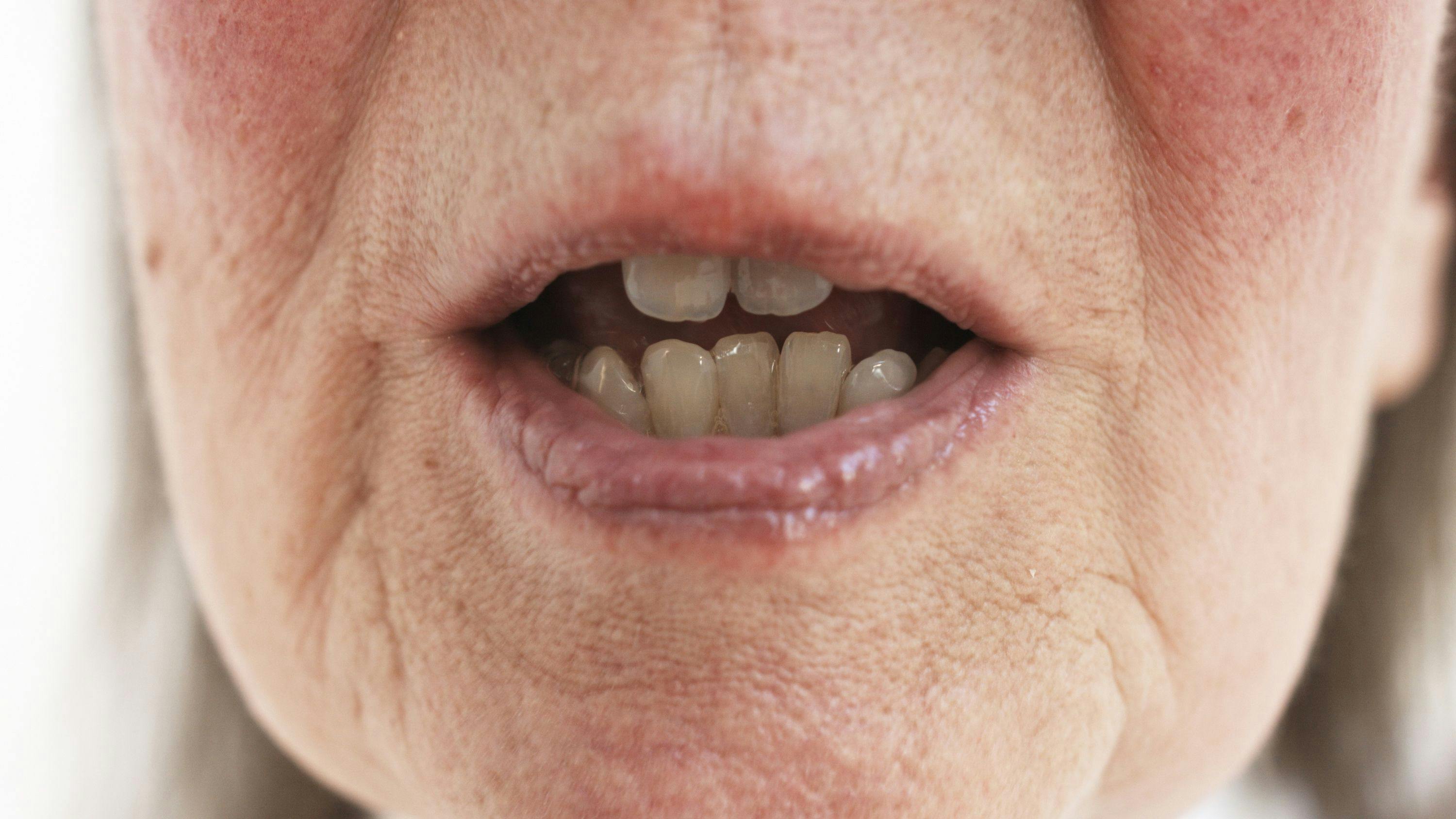 An extreme close up of a mouth. 